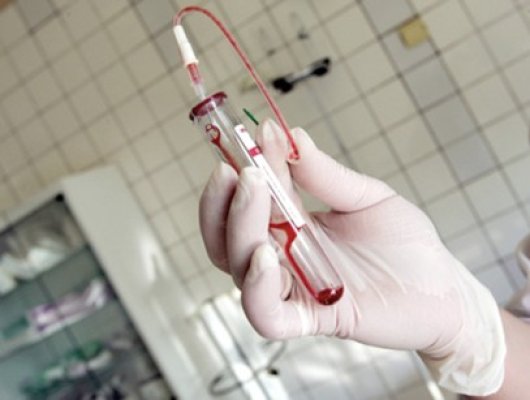 Două cazuri de hepatita A, depistate la Movila Verde